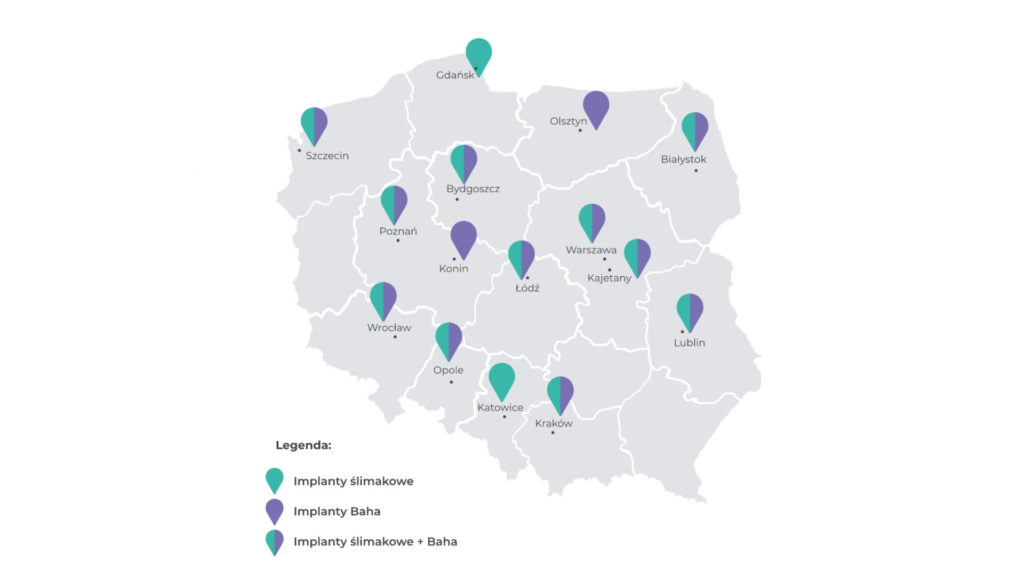 Warto wiedzieć- ponad 20 klinik wszczepiających implanty słuchowe w Polsce
